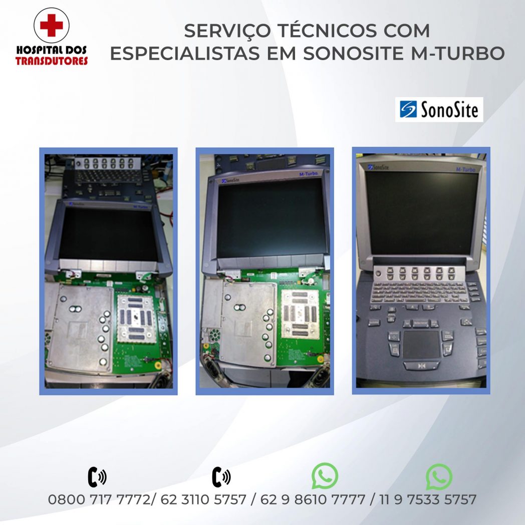 1-PLACA-SONOSITE-MTURBO