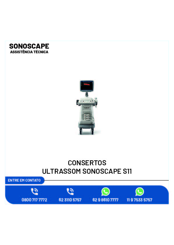 (7)-CONSERTOS-ULTRASSOM-SONOSCAPE-PORTATIL-X5-04