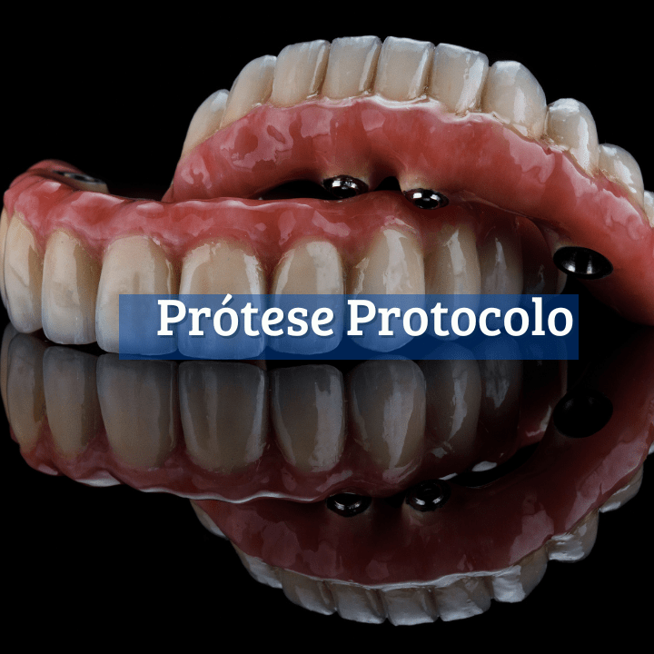 Dentista em Salvador I Dr Fausto Queiroz I Implante Dentário e etc (6)