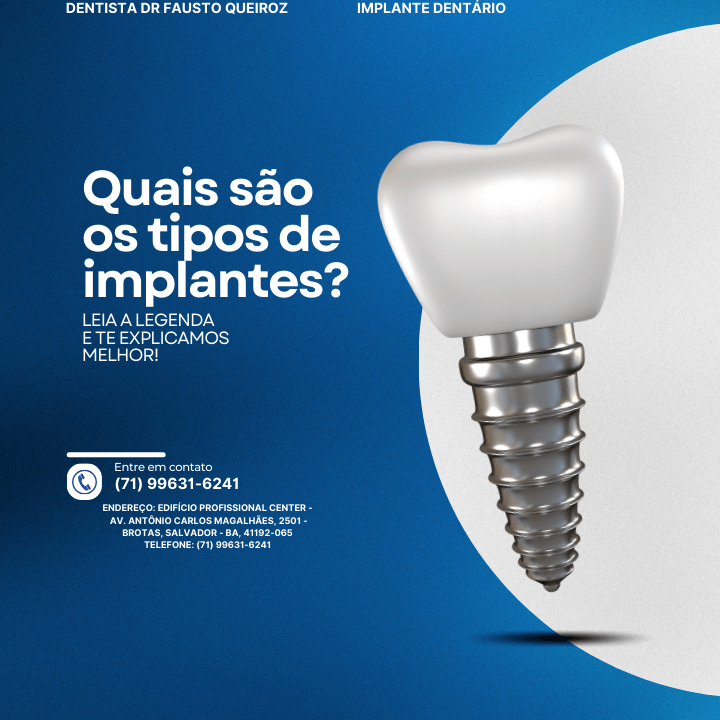 Dentista em Salvador I Dr Fausto Queiroz I Implante Dentário e etc (8)