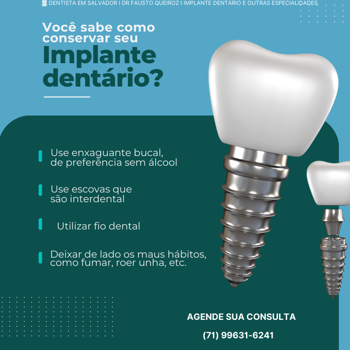 Dentista em Salvador I Dr Fausto Queiroz I Implante Dentário e etc. (9)