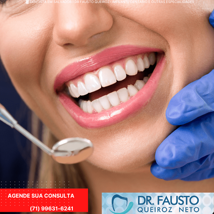 Dentista em Salvador I Dr Fausto Queiroz I Implante Dentário e etc (11) (1)